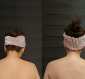 Фотоотчёт с результатами массажа шейно-воротниковой зоны