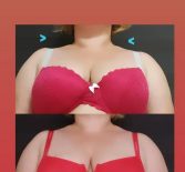 Фотоотчёт с результатами массажа шейно-воротниковой зоны