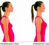 Осанка и её нарушения