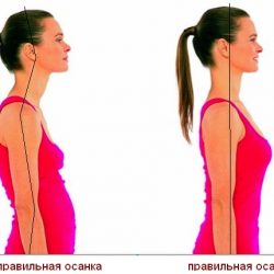 Осанка и её нарушения