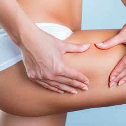 Видеоотчет с результатами антицеллюлитного массажа