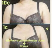 Фотоотчёт с результатами массажа шейно-воротниковой зоны и спины