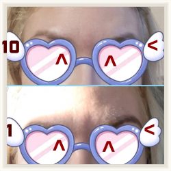 Фотоотчёт с результатами скульптурного массажа лица