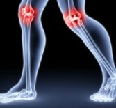 Антицеллюлитный массаж: зачем включать массаж коленей?