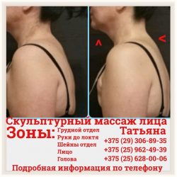 Фотоотчёт с результатами скульптурного массажа лица