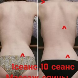 Фотоотчёт с результатами массажа спины
