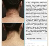 Фотоотчёт с результатами массажа шейно-воротниковой зоны