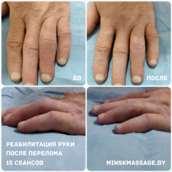 Реабилитационный массаж: путь к восстановлению и здоровью